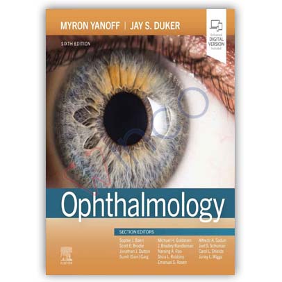 Ophthalmology 6th Edition