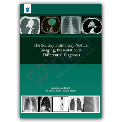 The Solitary Pulmonary Nodule, Imaging, Presentation & Differential Diagnosis