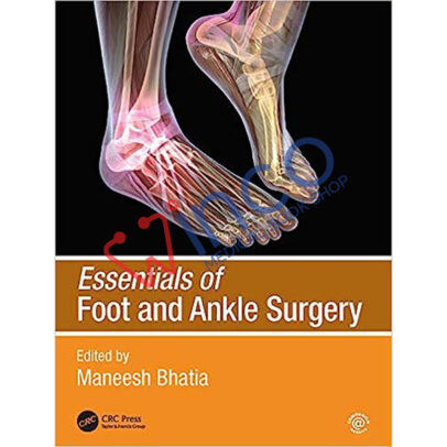Essentials of Foot and Ankle Surgery