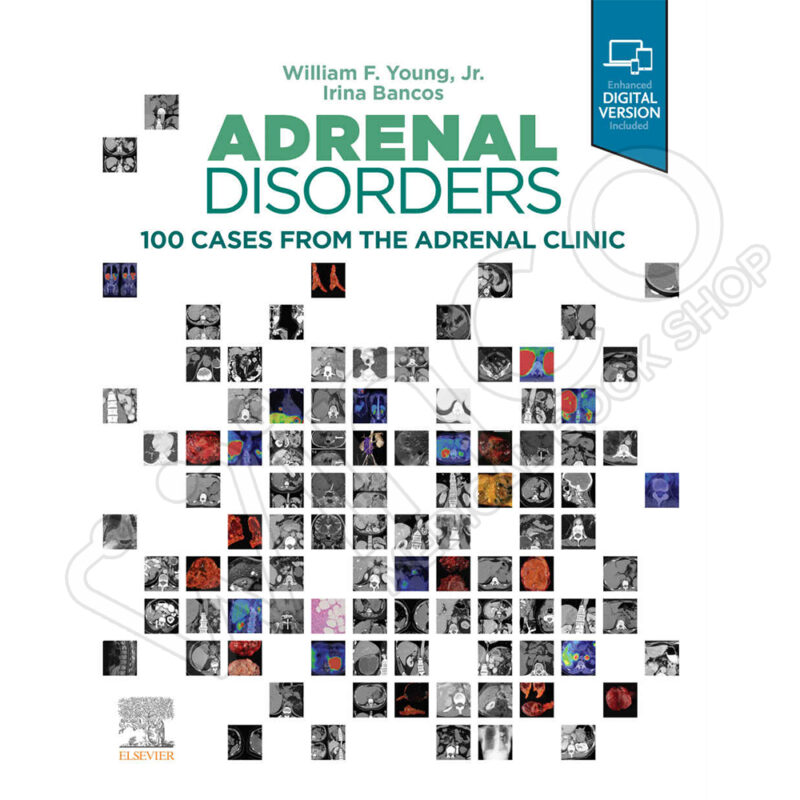 Adrenal Disorders: 100 Cases from the Adrenal Clinic