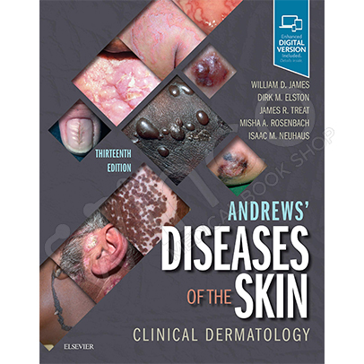 Andrew's Diseases Of The Skin: Clinical Dermatology 13th Edition
