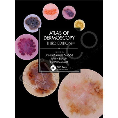 Atlas of Dermoscopy: Third Edition 3rd Edition