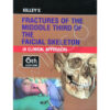 Killeys Fracture of the Middle Third of the Facial Skeleton