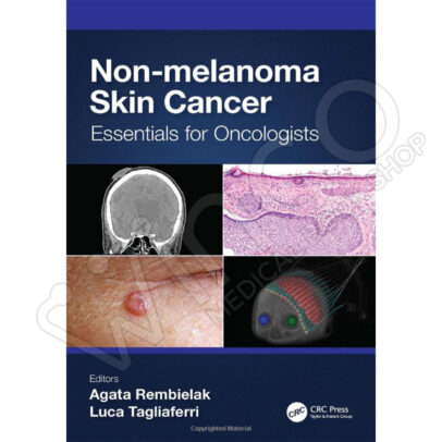 Non-Melanoma Skin Cancer Essentials for Oncologists 2023