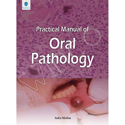 Practical Manual of Oral Pathology