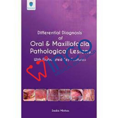 Differential Diagnosis of Oral and Maxillofacial Pathological Lesions