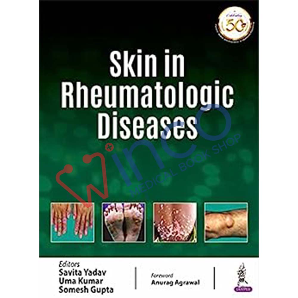 Skin In Rheumatologic Diseases