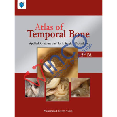 Atlas of Temporal Bone: Applied Anatomy and Basic Surgical Procedures 2nd Edition