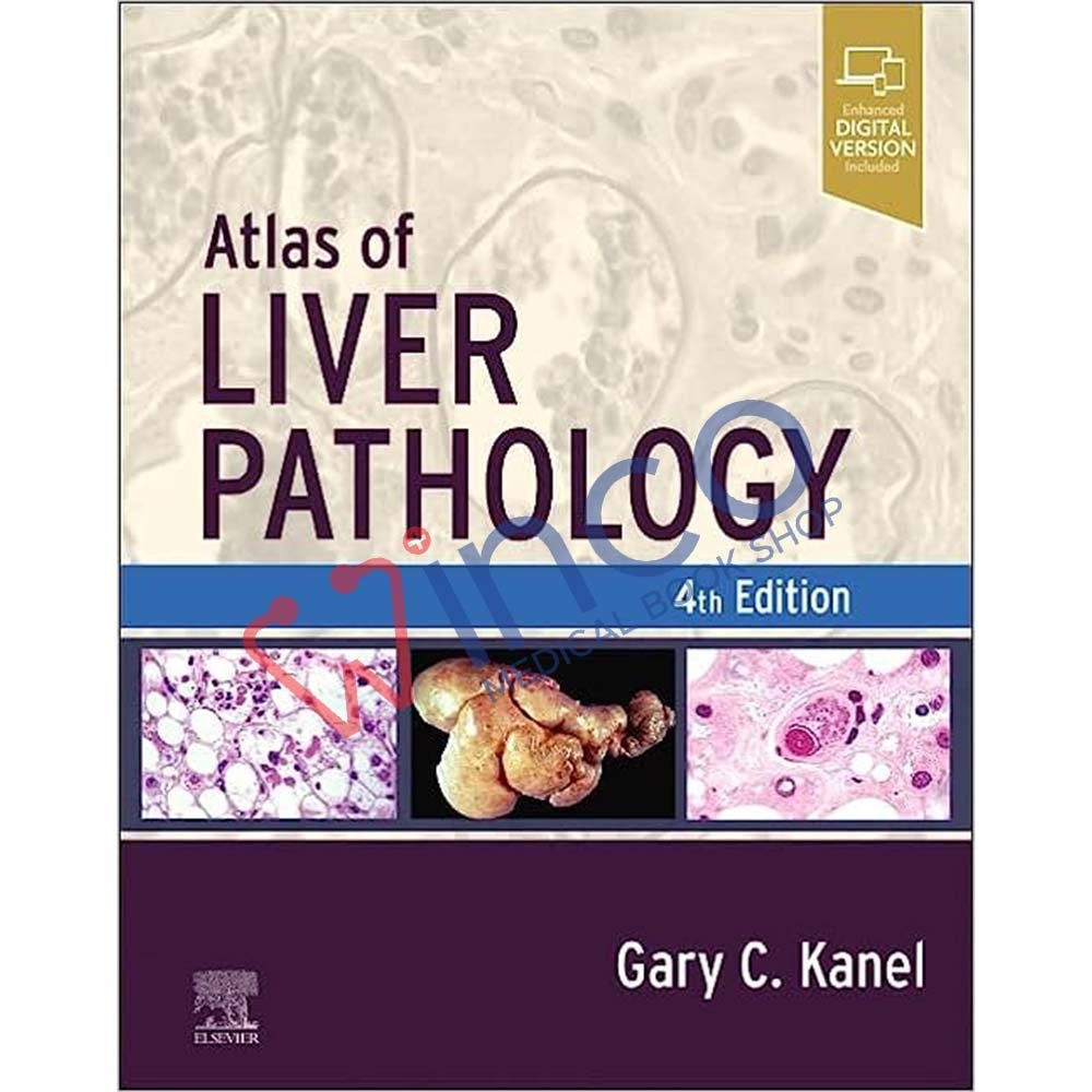 Atlas of Liver Pathology (Atlas of Surgical Pathology)