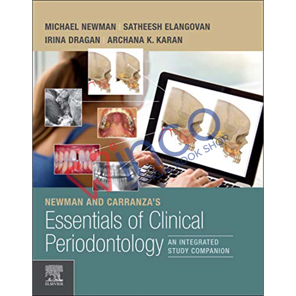 Newman and Carranza's Essentials of Clinical Periodontology: Newman and Carranza's Essentials of Clinical Periodontology 1st Edition