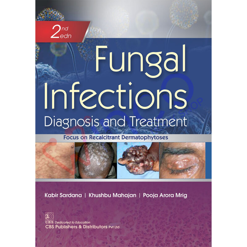 Fungal Infections Diagnosis And Treatment - Winco Medical Book Store