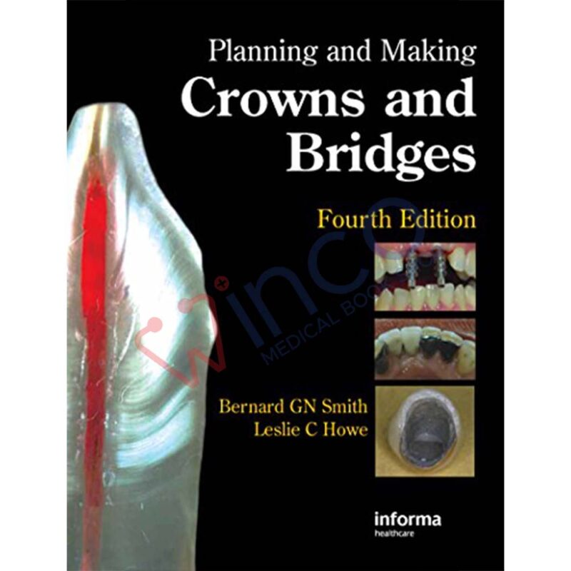 Planning and Making Crowns and Bridges