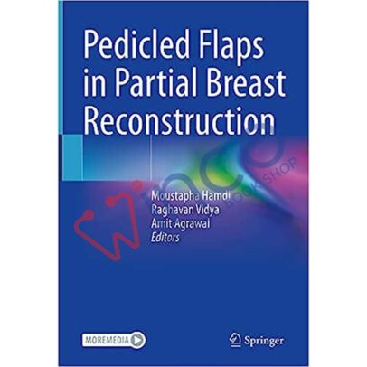Pedicled Flaps in Partial Breast Reconstruction