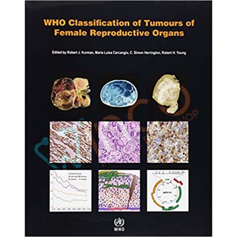 WHO Classification of Tumours of the Female Reproductive Organs