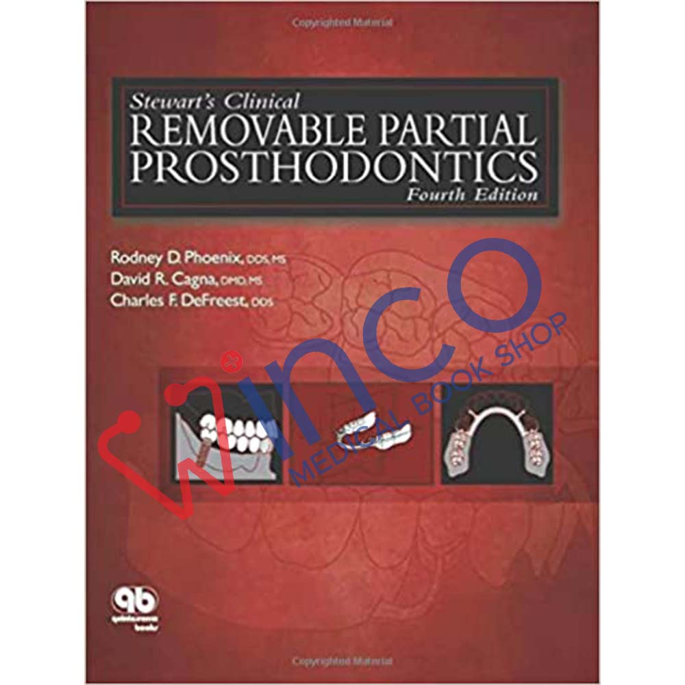 Stewart's Clinical Removable Partial Prosthodontics, 4th Edition ...