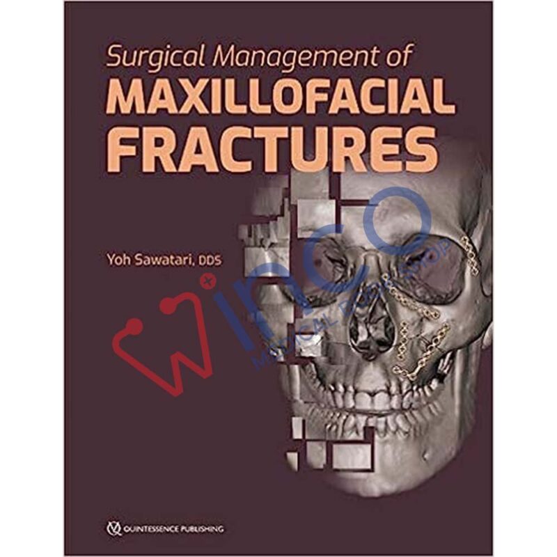 Surgical Management of Maxillofacial Fractures 1st Edition