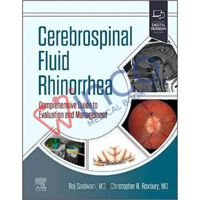 Cerebrospinal Fluid Rhinorrhea: Comprehensive Guide to Evaluation and Management