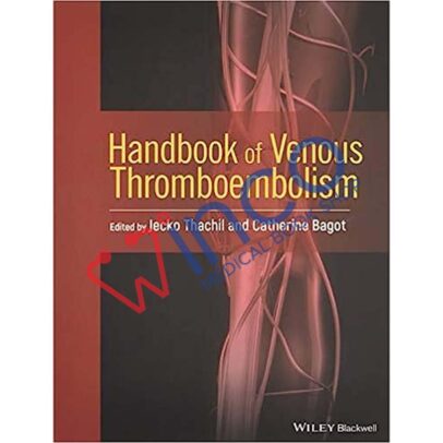 Handbook of Venous Thromboembolism