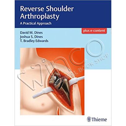 Reverse Shoulder Arthroplasty: A Practical Approach