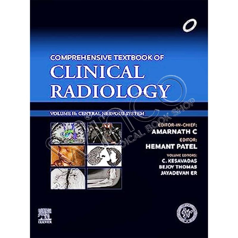 Comprehensive Textbook Of Clinical Radiology: Central Nervous System ...