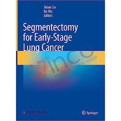 Segmentectomy for Early-Stage Lung Cancer: 3D Navigation 1st ed. 2023 Edition