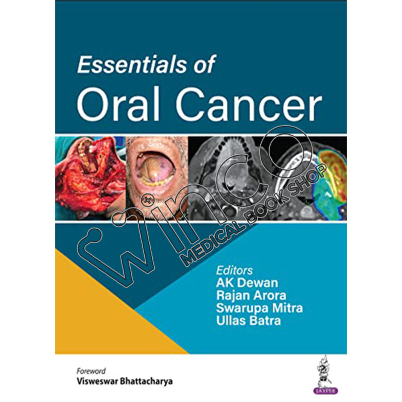 Essentials of Oral Cancer 1st Edition