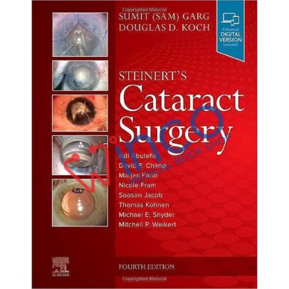 Steinert's Cataract Surgery 4th Edition