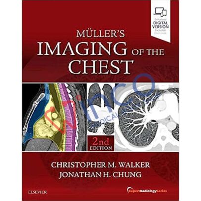 Muller's Imaging of the Chest: Expert Radiology Series 2nd Edition