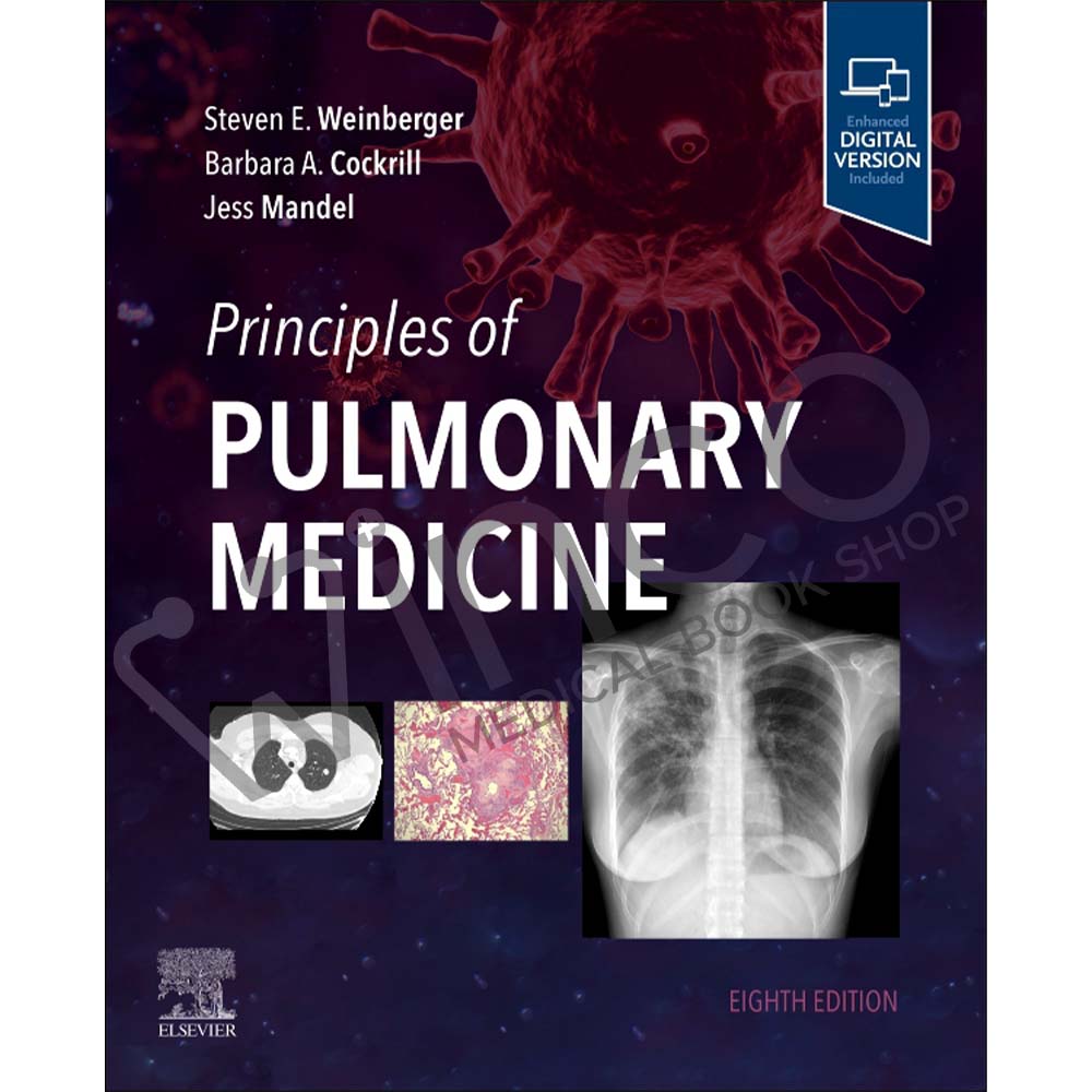 Principles of Pulmonary Medicine 8th Edition