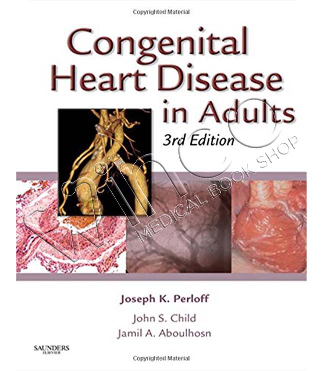Congenital Heart Disease in Adults, 3rd Edition