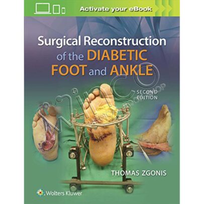 Surgical Reconstruction of the Diabetic Foot and Ankle, 2nd Edition