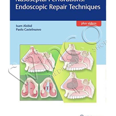 Nasoseptal Perforations: Endoscopic Repair Techniques
