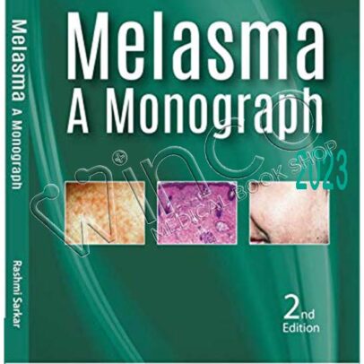 Melasma: A Monograph, 2nd Edition