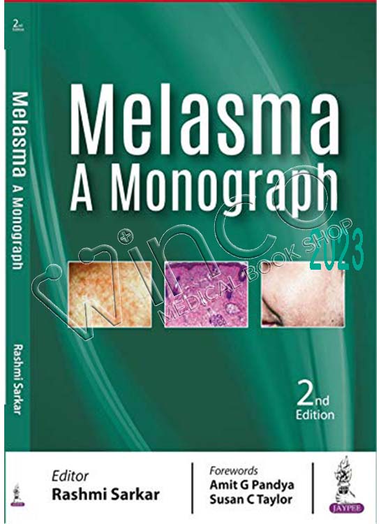 Melasma: A Monograph, 2nd Edition