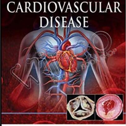 Illustrated Guide to Cardiovascular Disease
