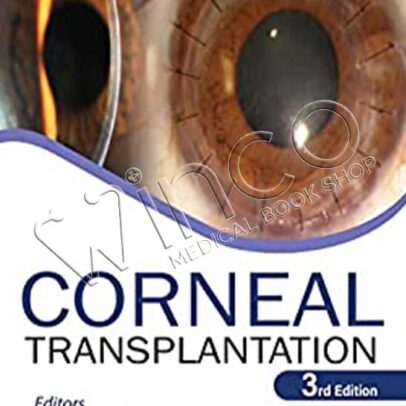 Corneal Transplantation, 3rd edition