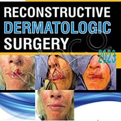 Reconstructive Dermatologic Surgery
