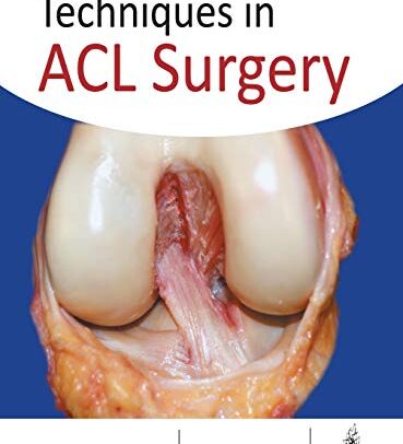 Techniques in ACL Surgery