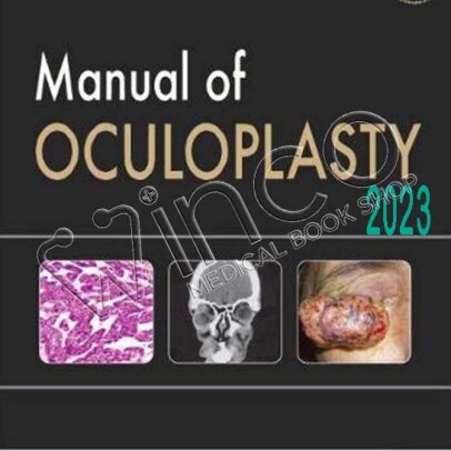 Manual of Oculoplasty