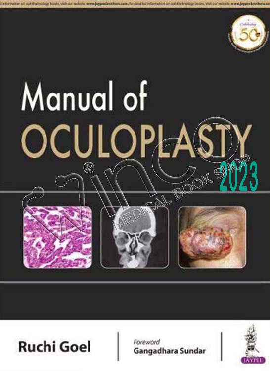 Manual of Oculoplasty