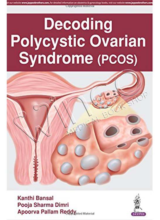 Decoding Polycystic Ovarian Syndrome (PCOS)