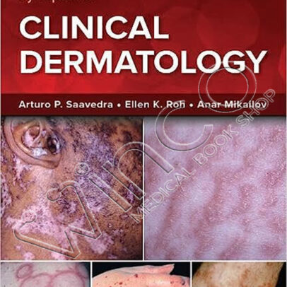 Fitzpatrick's Color Atlas and Synopsis of Clinical Dermatology, Ninth Edition
