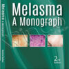 Melasma A Monograph, 2nd Edition