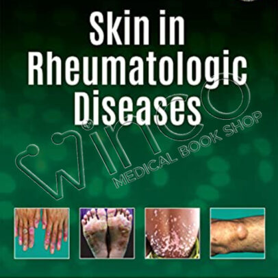 Skin In Rheumatologic Diseases Winco MEDical Book