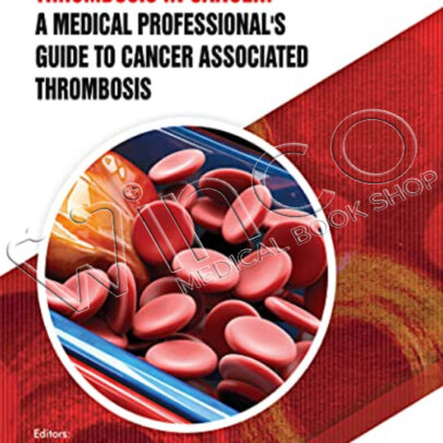 Thrombosis in Cancer