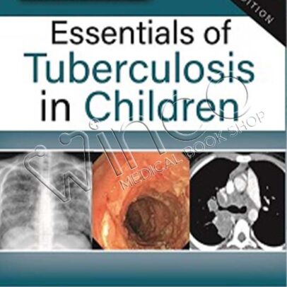 Essentials of Tuberculosis in Children, 5th Edition