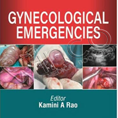 Gynecological Emergencies, 2nd Edition