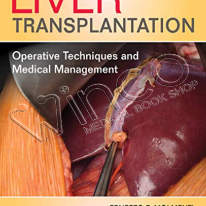 Liver Transplantation: Operative Techniques and Medical Management