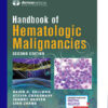 handbook of hematologic malignancies 2nd edition