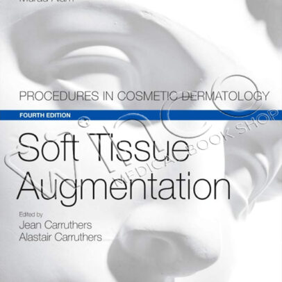 soft tissue augmentation